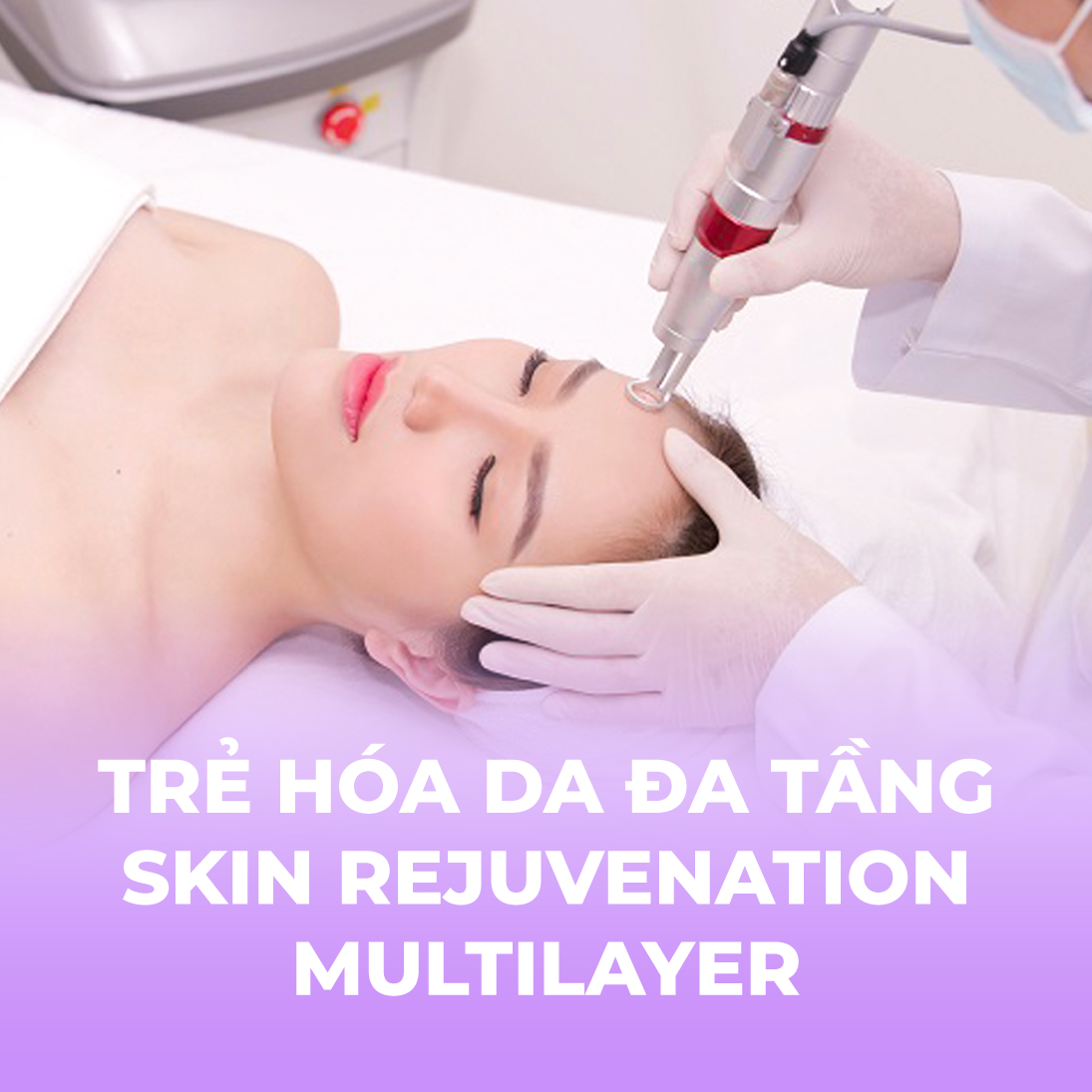 Trẻ hóa da đa tầng - Skin rejuvenation multilayer - 1 buổi