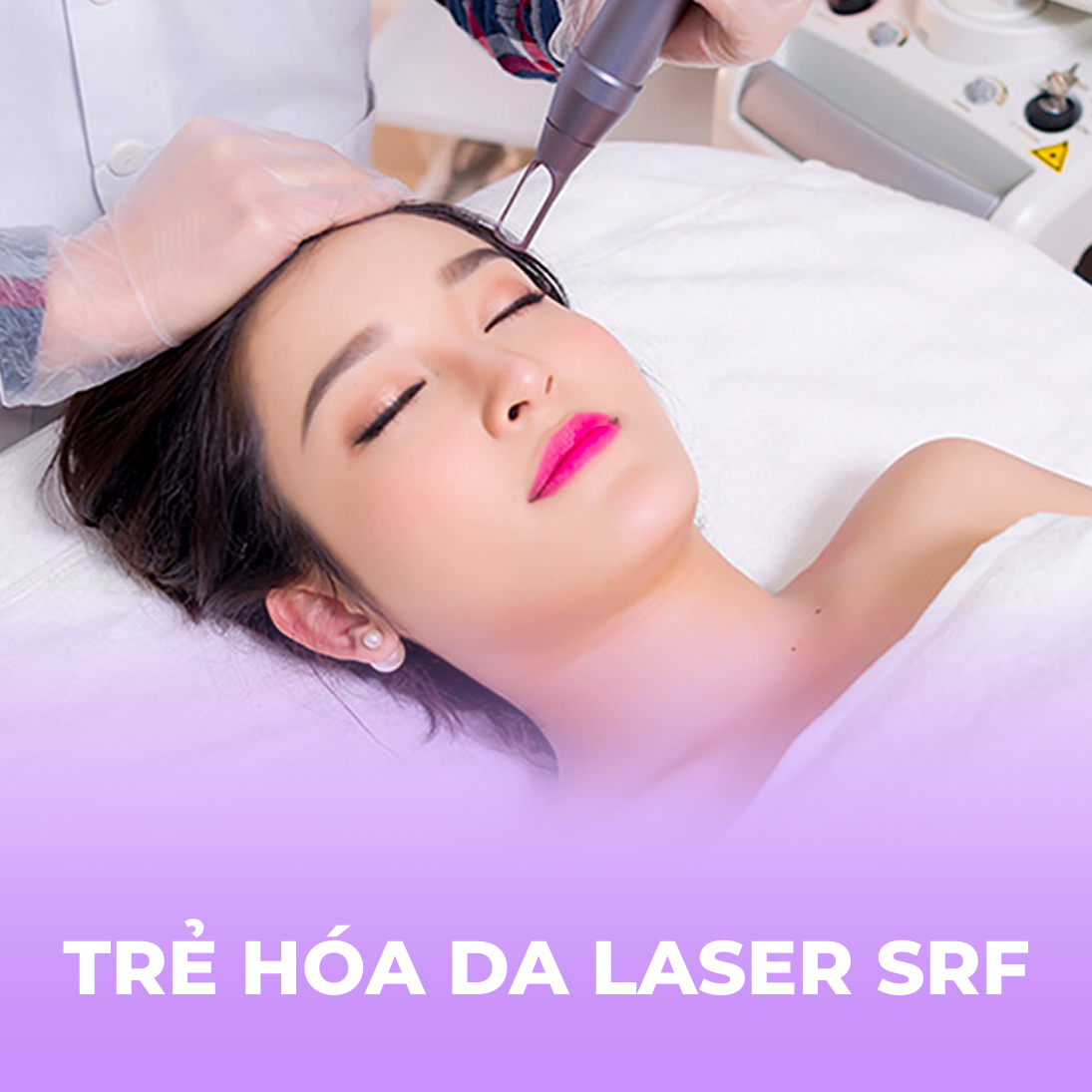 Trẻ hóa da - Laser SRF - 1 buổi