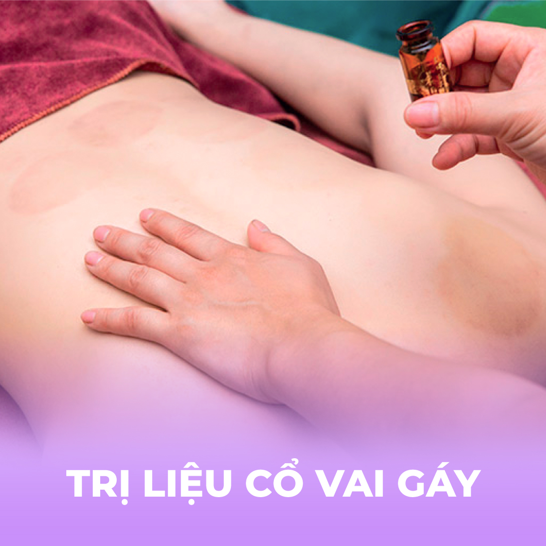 Trị liệu cổ vai gáy - 1 buổi