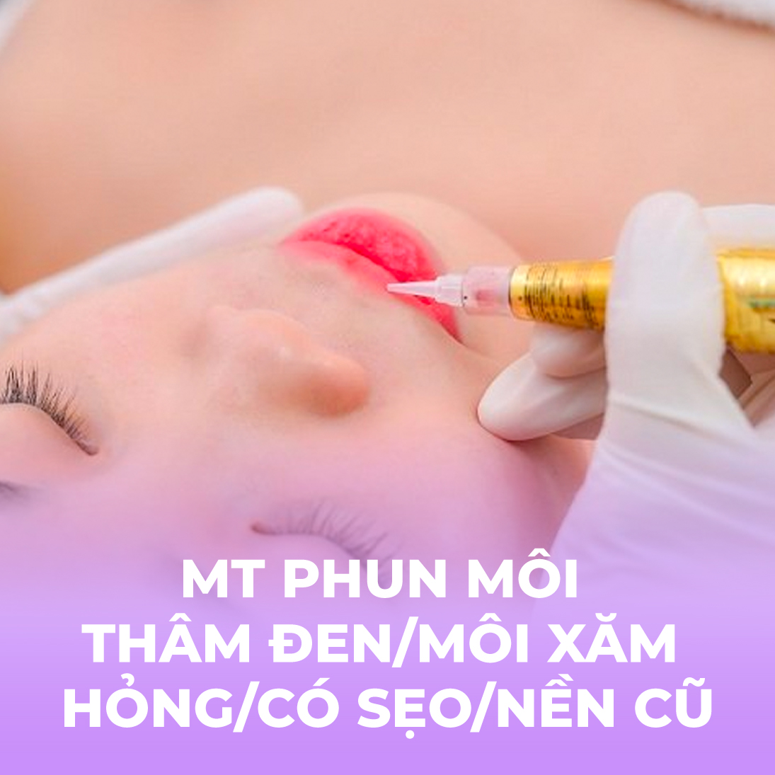 Phun môi thâm đen/môi xăm hỏng/môi có sẹo/môi đã có nền cũ - 1