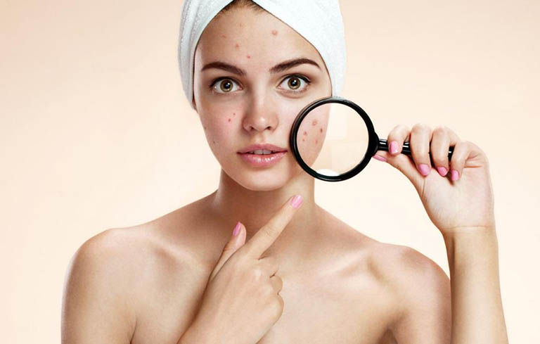 Quy trình chăm sóc da mụn chuẩn Y khoa từ Bác sĩ da liễu