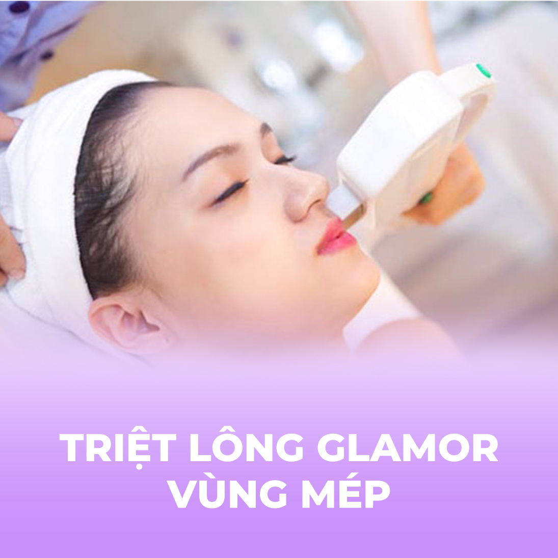 Triệt lông Glamor - Vùng mép - 10 buổi