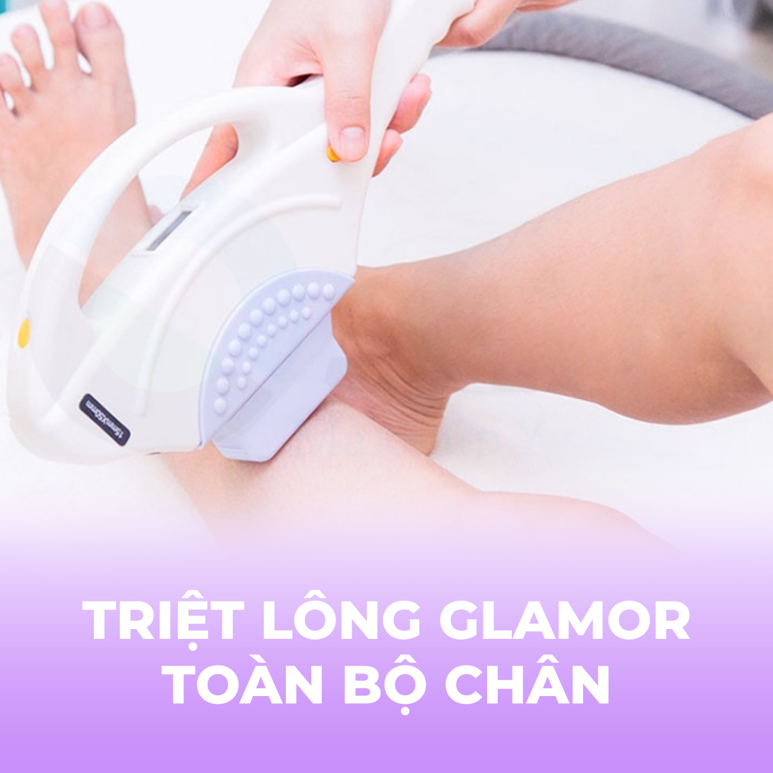 Triệt lông Glamor - Toàn bộ chân - 10 buổi