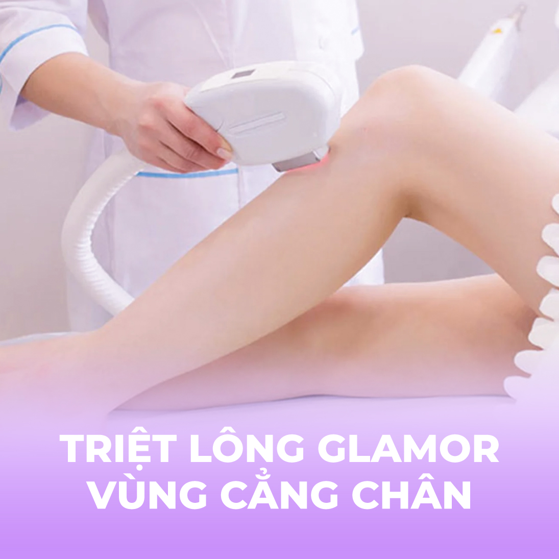 Triệt lông Glamor - Vùng cẳng chân - 10 buổi