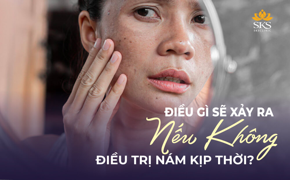 ĐIỀU GÌ SẼ XẢY RA NẾU KHÔNG ĐIỀU TRỊ NÁM KỊP THỜI?