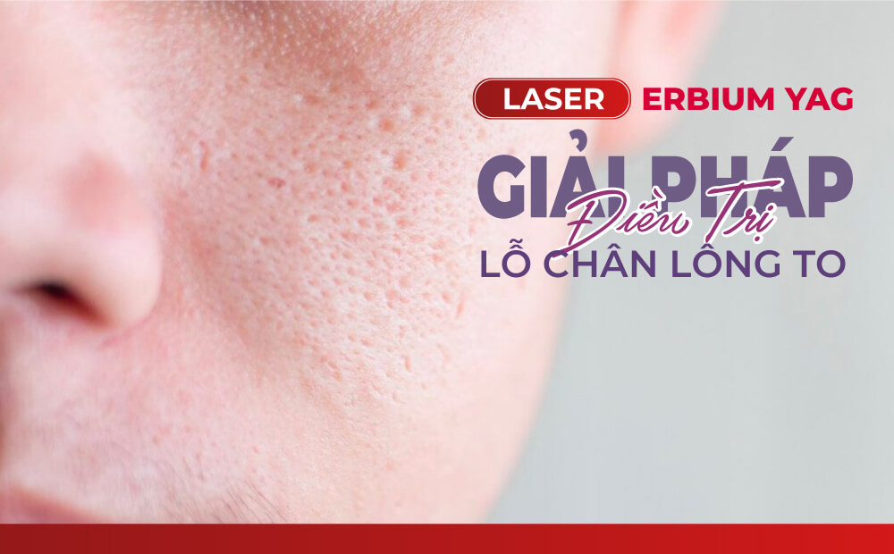 LASER ERBIUM YAG - GIẢI PHÁP ĐIỀU TRỊ LỖ CHÂN LÔNG TO