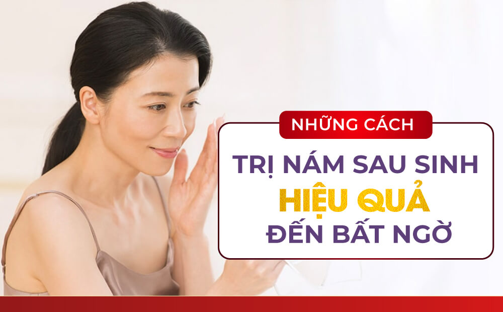 NHỮNG CÁCH TRỊ NÁM SAU SINH HIỆU QUẢ ĐẾN BẤT NGỜ