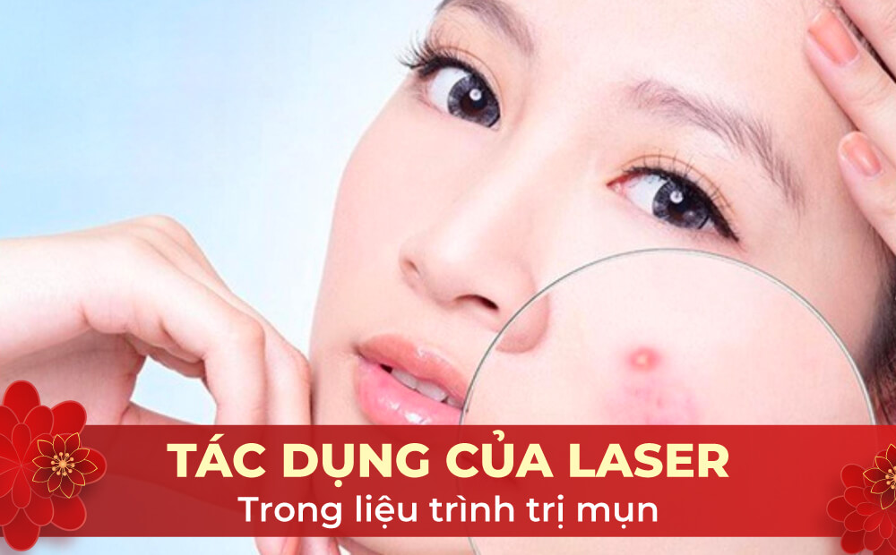 TÁC DỤNG CỦA LASER TRONG LIỆU TRÌNH TRỊ MỤN