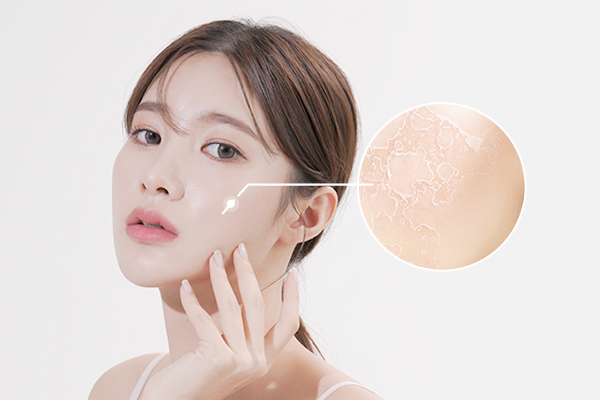 PHÂN BIỆT GIỮA DA KHÔ VÀ DA MẤT NƯỚC - CÁCH KHẮC PHỤC HIỆU QUẢ