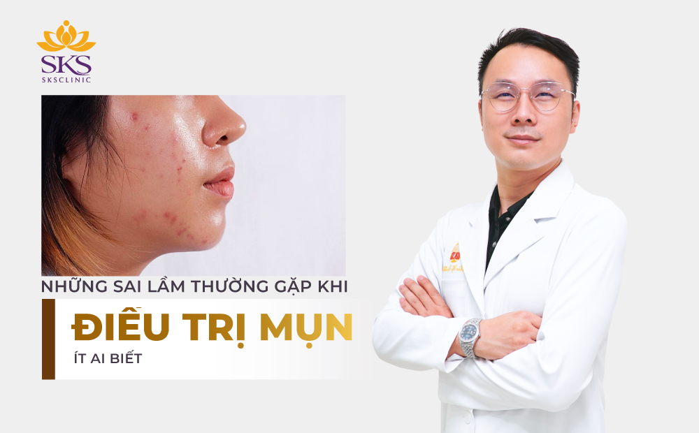 NHỮNG SAI LẦM THƯỜNG GẶP KHI ĐIỀU TRỊ MỤN ÍT AI BIẾT
