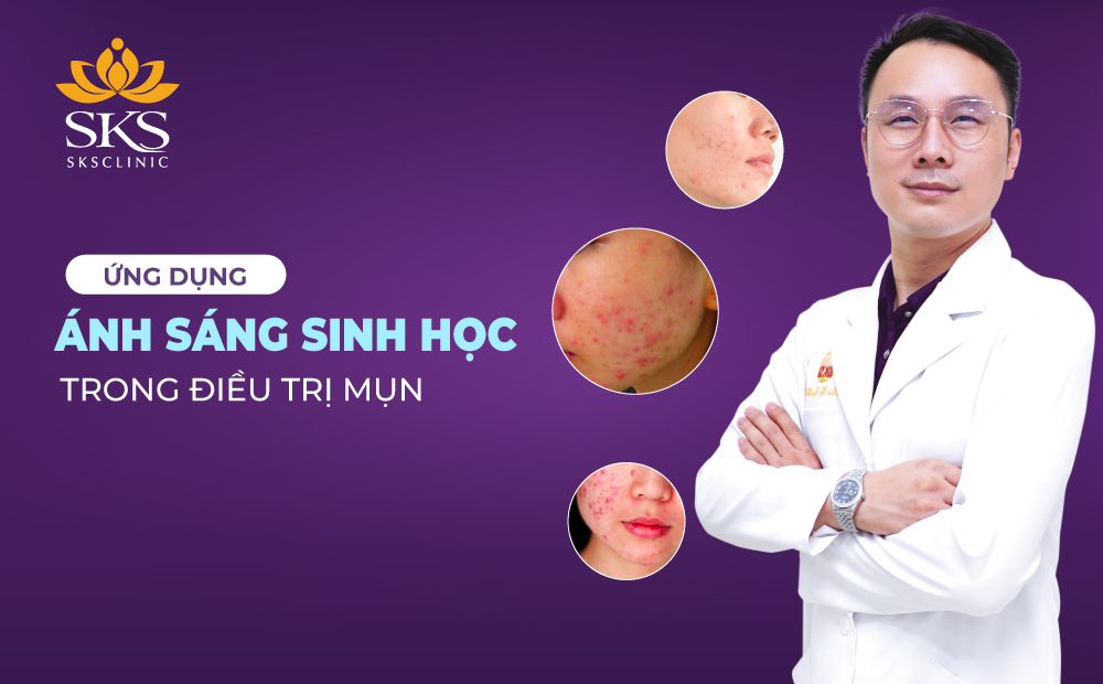 ỨNG DỤNG ÁNH SÁNG SINH HỌC TRONG LIỆU TRÌNH ĐIỀU TRỊ MỤN