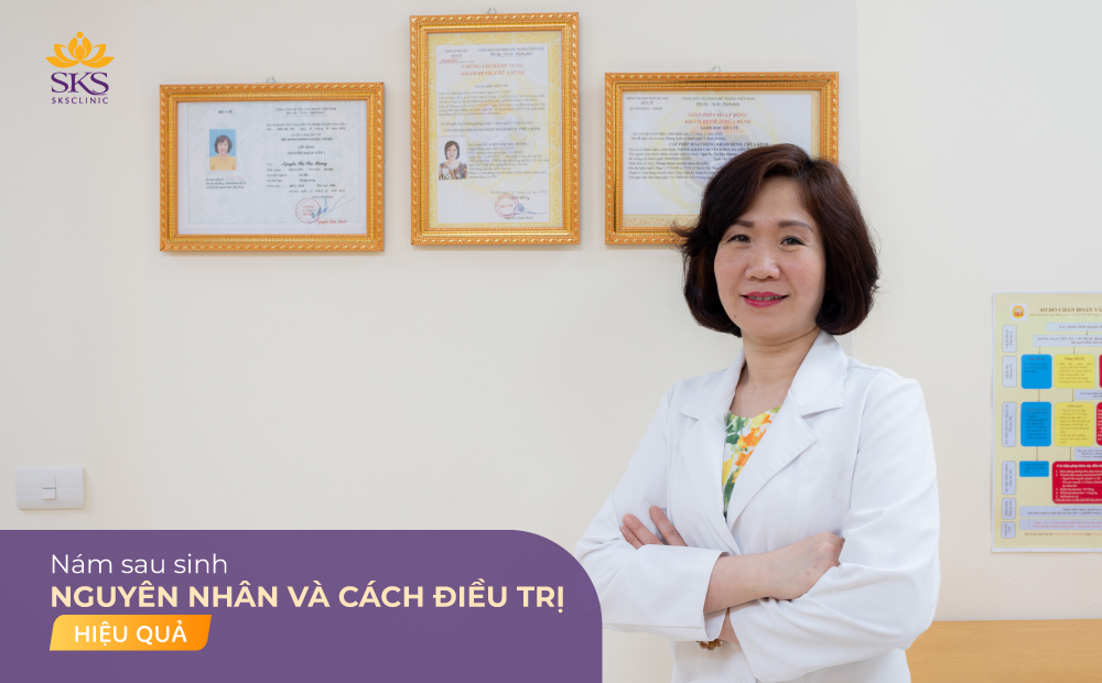 NÁM SAU SINH - NGUYÊN NHÂN VÀ CÁCH ĐIỀU TRỊ HIỆU QUẢ