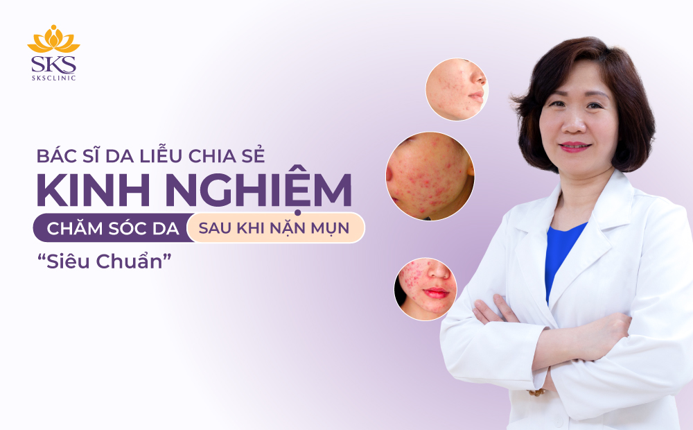 BÁC SĨ DA LIỄU CHIA SẺ KINH NGHIỆM CHĂM SÓC DA SAU KHI NẶN MỤN 