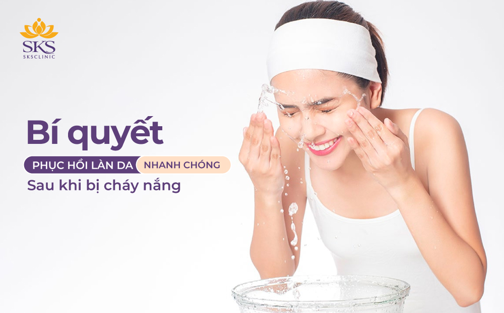 BÍ QUYẾT PHỤC HỒI LÀN DA NHANH CHÓNG SAU KHI BỊ CHÁY NẮNG
