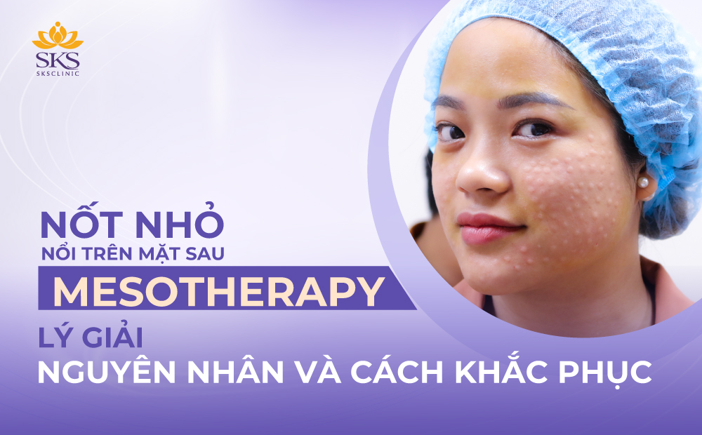 NỐT NHỎ NỔI TRÊN MẶT SAU MESOTHERAPY CÓ SAO KHÔNG? KHẮC PHỤC NHƯ THẾ NÀO?