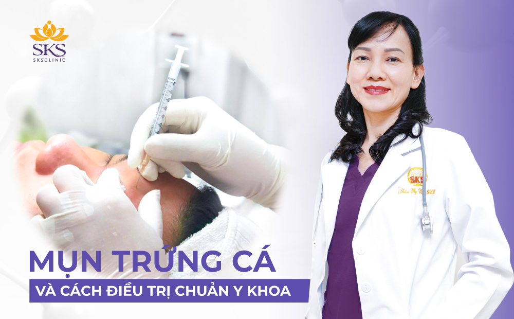 MỤN TRỨNG CÁ VÀ CÁCH ĐIỀU TRỊ CHUẨN Y KHOA TẠI SKS CLINIC