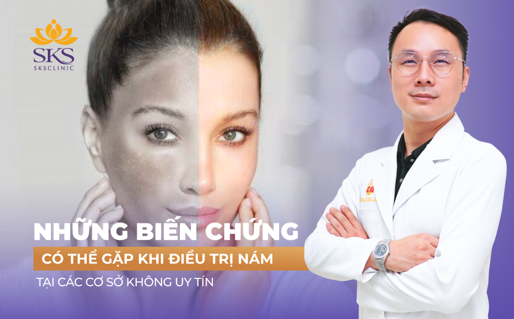 NHỮNG BIẾN CHỨNG CÓ THỂ GẶP KHI ĐIỀU TRỊ NÁM TẠI CÁC CƠ SỞ KHÔNG UY TÍN