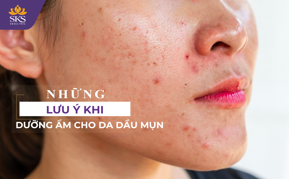 NHỮNG LƯU Ý KHI DƯỠNG ẨM CHO DA DẦU MỤN TRONG MÙA ĐÔNG