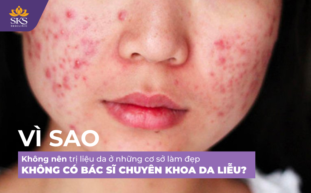 VÌ SAO KHÔNG NÊN TRỊ LIỆU DA Ở NHỮNG CƠ SỞ LÀM ĐẸP KHÔNG CÓ BÁC SĨ DA LIỄU?