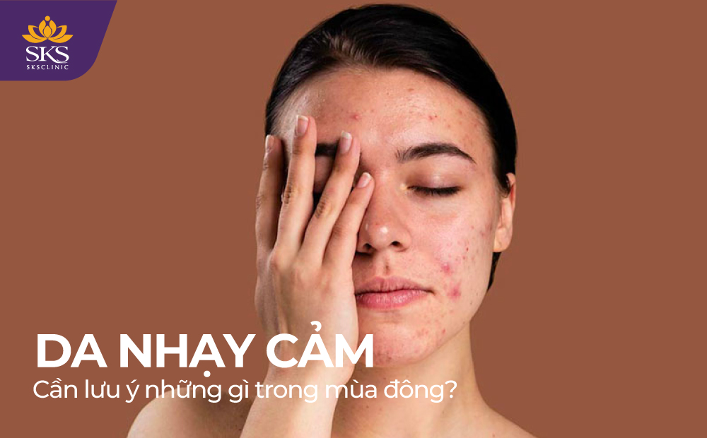 CHĂM SÓC LÀN DA NHẠY CẢM CẦN LƯU Ý NHỮNG GÌ TRONG MÙA ĐÔNG?