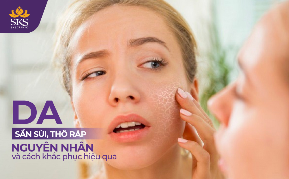 DA SẦN SÙI, THÔ RÁP - NGUYÊN NHÂN VÀ CÁCH KHẮC PHỤC HIỆU QUẢ