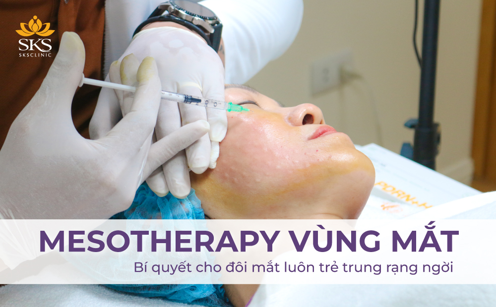 MESOTHERAPY VÙNG MẮT - BÍ QUYẾT CHO ĐÔI MẮT LUÔN TRẺ TRUNG RẠNG NGỜI