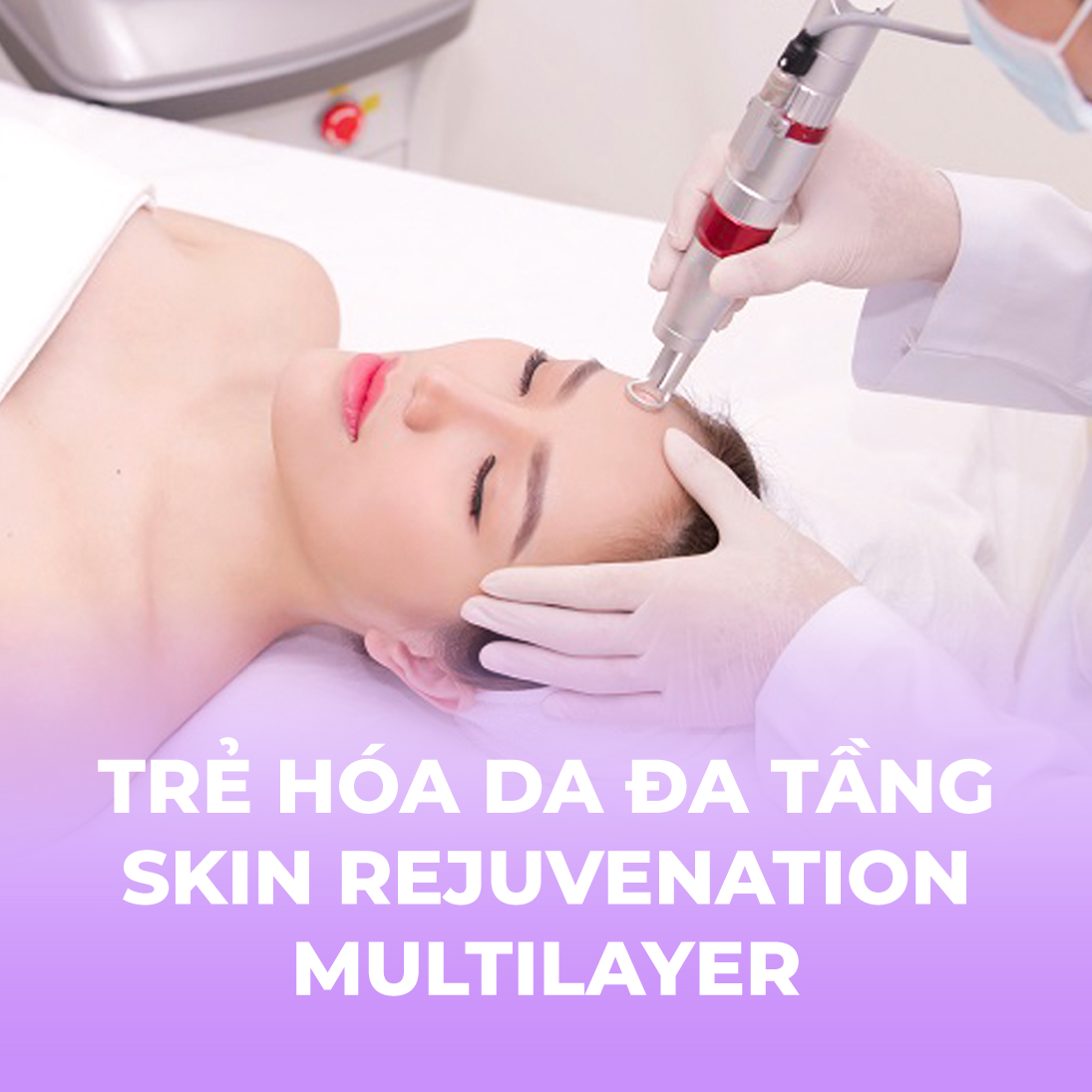 	Trẻ hóa da đa tầng - Skin rejuvenation multilayer - 5 buổi