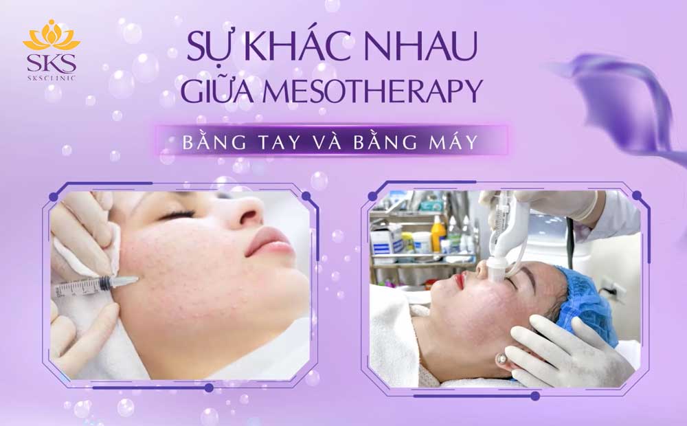 SO SÁNH SỰ KHÁC NHAU GIỮA MESOTHERAPY BẰNG TAY VÀ BẰNG MÁY